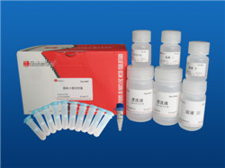 国标法尿碘试剂盒|微生物检测