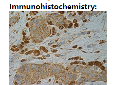 Anti BRaf(V600E) Mouse Monoclonal Antibody