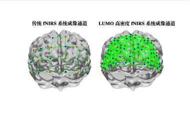LUMO近红外脑功能超扫描系统