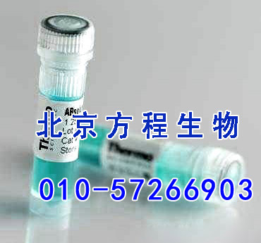 方程生物试剂图片 (4).jpg 人毛细血管扩张性共济失调突变因子(ATM)检测/(ELISA)kit试剂盒/免费检测