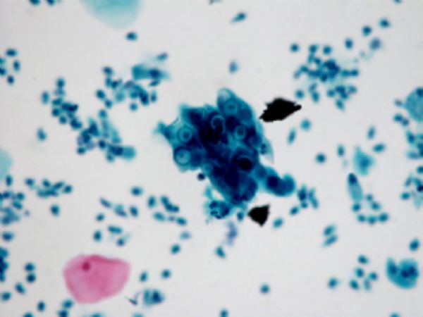 抗丙型肝炎病毒核心抗原单克隆抗体杂交瘤细胞株,HCV-C39